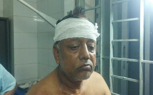 ভোট চেয়ে বাড়ি ফেরার পথে মাথা ফাটালো প্রতিপক্ষ 