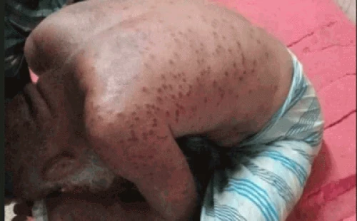 ময়মনসিংহে ভিমরুলের কামড়ে ভাই-বোন ও বাবার মৃত্যু 