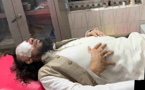 সড়ক দুর্ঘটনায় আহত ইসলামি বক্তা আব্দুল হাই সাইফুল্লাহ 