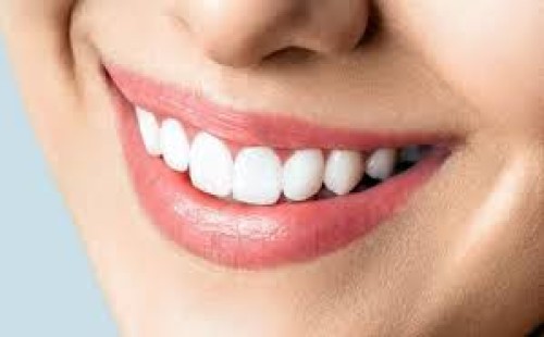 দাঁতে পোকার বিষয়ে বিজ্ঞান কী বলে? 