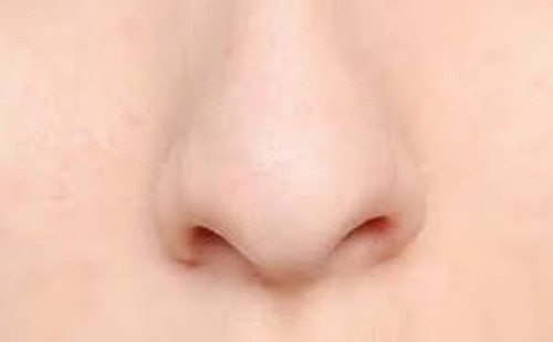 নাকের মাংসবৃদ্ধি, পরিত্রাণের উপায় 