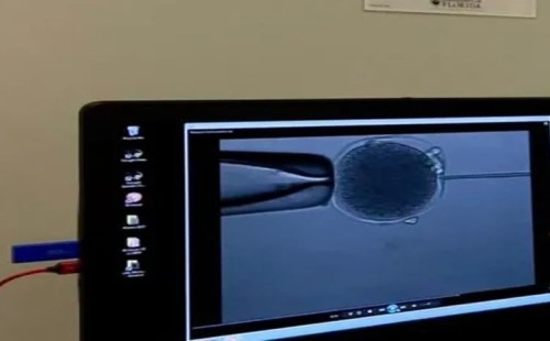 ল্যাবরেটরিতে ক্যাঙ্গারুর ভ্রূণ তৈরি 