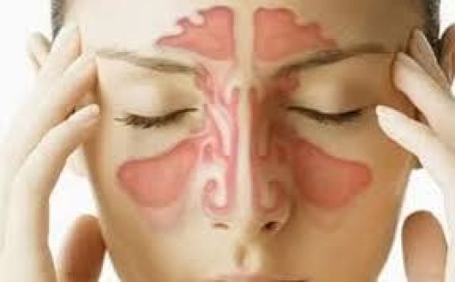 সাইনোসাইটিস: কারণ, ক্ষতি ও প্রতিকার 