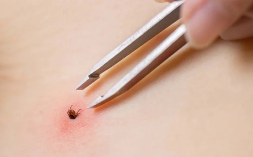 মঙ্গোলিয়ায় টিক-বাহিত রোগে আক্রান্ত ৪৪ জন 