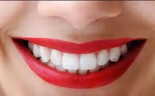 দাঁতের দাগ দূর করার সহজ কিছু ঘরোয়া পদ্ধতি 