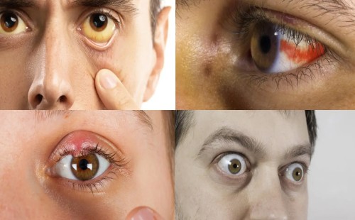 চোখ দেখেই চিহ্নিত করা যাবে রোগের লক্ষণ! 