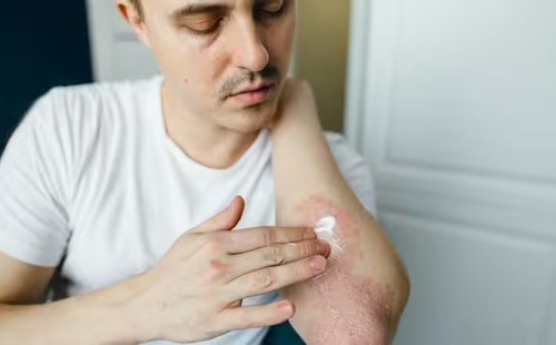 মেগা থ্রি ফ্যাটি এসিডের ঘাটতির লক্ষণ কীভাবে বুঝবেন 