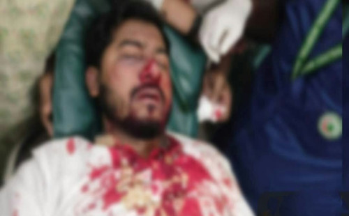 সংঘর্ষে মারাত্মক আহত নুরুল হক নুর, রক্তাক্ত অবস্থায় নেওয়া হলো হাসপাতালে 