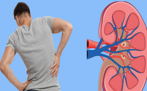 ঘরে বসেই সহজ পদ্ধতিতে পরীক্ষা করুন কিডনি 